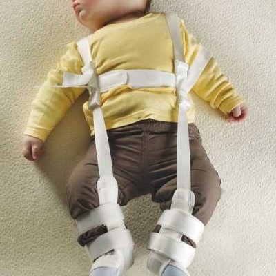 Pavlik Bandage